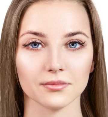 Bladeless LASIK Transformation before